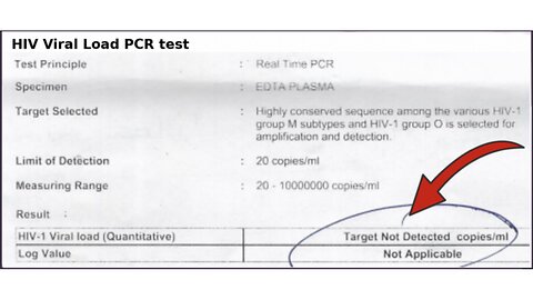 HIV PCR Test Result - HIV NOT DETECTED #2