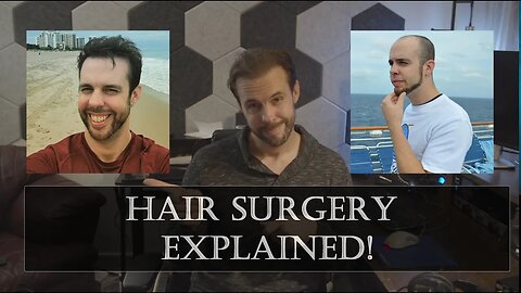 Chris Rupp Hair Transplant Journey!