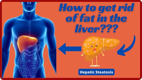 Steatosis - How to get rid of fat in liver?