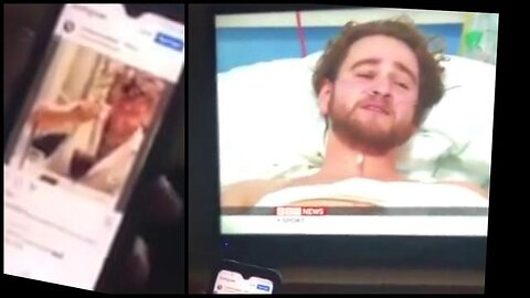 Henry Dyne "Award winning crisis actor" playing patient who was hospitalised with coronavirus 💉☠️💉
