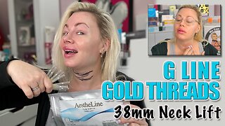 Neck Lift with G Line Gold Threads, AceCosm| Code Jessica10 Saves you money