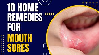 10 Home Remedies for Mouth Sores You Haven't Tried Yet!