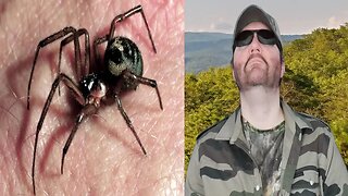 Arachnophobia Images Witn Unnerving Music (DarkStatic) REACTION!!! (BBT)