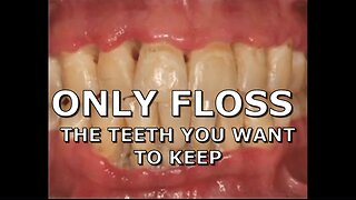 ONLY FLOSS THE TEETH YOU WANT TO KEEP