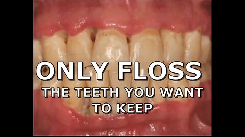 ONLY FLOSS THE TEETH YOU WANT TO KEEP