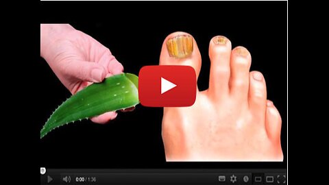 This Sweet Oil + Aloe Vera = Nail Fungus Gone