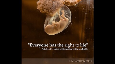 WARNING GRAPHIC: Partial-Birth Abortion does not belong in a CIVILIZED SOCIETY. The RIGHT to LIFE!?