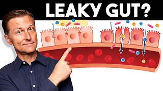 7 Signs of a Leaky Gut — Dr. Berg