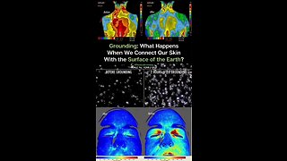 Groudning: What Happens When We Connect Our Skin With The Surface Of The Earth?