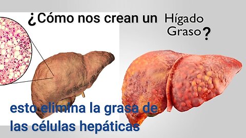 QUÉ ES LO QUE CREA EL HÍGADO GRASO, CÓMO ELIMINAR ESA GRASA Y REPARAR LAS CÉLULAS HEPÁTICAS