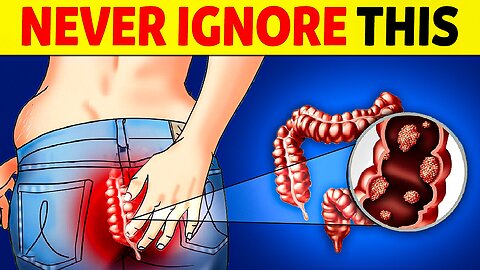 5 Critical Colon Cancer Symptoms You Need To Know!