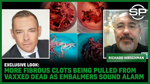EXCLUSIVE LOOK: MORE Fibrous Clots Being Pulled From Vaxxed DEAD As Embalmers Sound Alarm