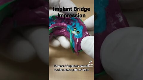 Dental Implant Bridge Impression Tip #dentistry