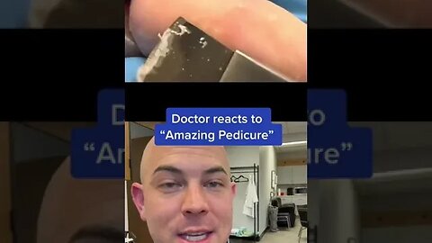 Doctor reacts to massive callus removal! #callus #callusremoval #doctorreacts #dermreacts