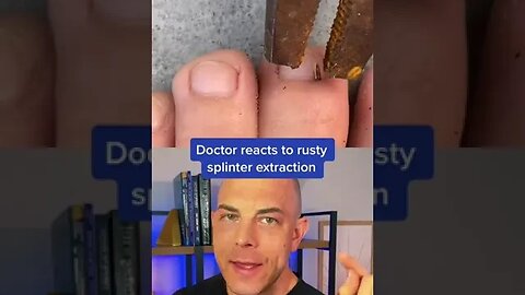 Doctor reacts to rusty splinter extraction! #bigsplinter #dermreacts #tetnus