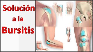 COMBATIR LA BURSITIS DE FORMA NATURAL, BOLSAS SINOVIALES, BURSA