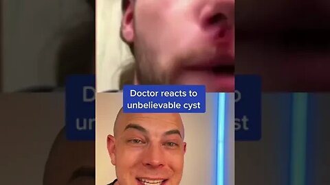 Doctor reacts to unbelievable cyst! #cyst #pimplepop #dermreacts