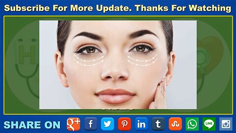 4-home-treatments-to-get-rid-of-dark-circles-under-eyes-naturally-givefastlink