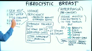 Fibrocystic Breast: The Best Remedy is...Iodine [Mirrored]