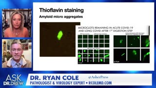 Dr. Ryan Cole: Blood Clots Include Amyloid, Not Found in Normal Blood Clots