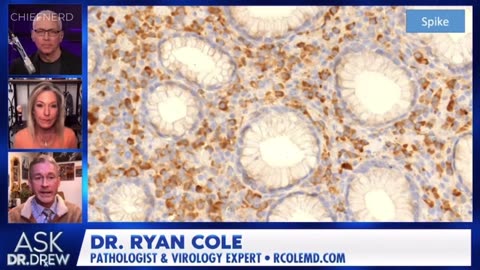 Dr. Ryan Cole: Spike Proteins in Terrifying Biopsy Results Which Could Explain Rise in Cancers