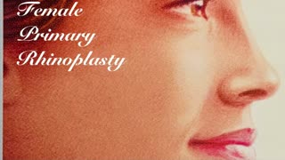 Female primary rhinoplasty