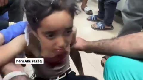 A Palestinian girl suffered injuries during an Israeli airstrike in Deir al-Balah