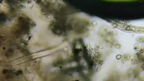 Purchased Eggs Under The Microscope~This Is Why It Is Recommended To Wash Eggs Before Cooking Them!