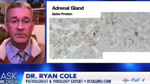 spike protein filling the entire adrenal gland.