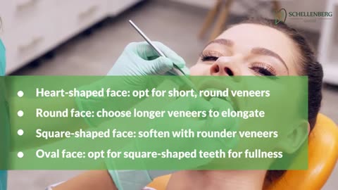 Tips for Selecting Veneers