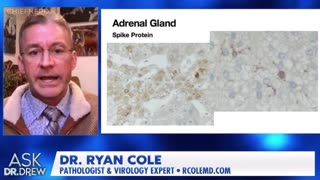 🚨 Dr. Ryan Cole Shares New Autopsy Results Showing Vaccine Spike Protein in the Adrenal Gland