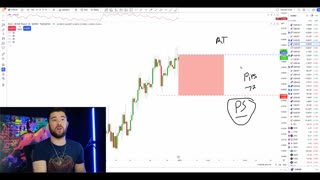 Risk Management In Forex Was Hard.. Till I Discovered This Easy 3-Step Secret (Beginner To Advanced)