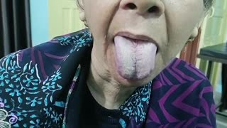 Abnormal tongue movement