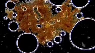 Watch Peroxide Kill Bacteria Under a Microscope..