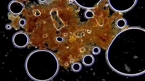 Watch Peroxide Kill Bacteria Under a Microscope..