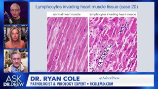 Dr. Ryan Cole: mRNA in Deltoid and Heart Muscle
