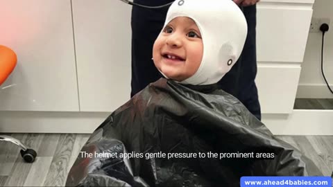 Treatment For Plagiocephaly Infant Helmet