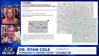 Dr. Ryan Cole Analyzes mRNA Crossing the Blood - Brain Barrier