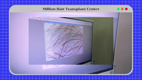 Million Hair Transplant Center คลินิกปลูกผม