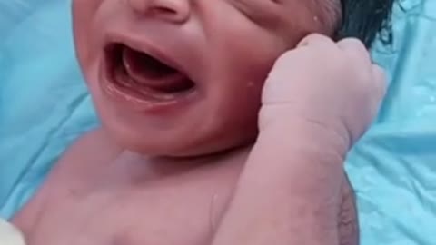 Baby body is so hairy and cute just after born