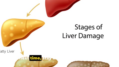 7 Warning Signs of Fatty Liver Disease