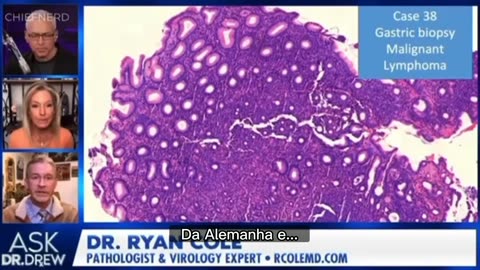 💉⚠️Dr. Ryan Cole - Resultados de biópsia mostram Proteínas Spike nas células cancerosas⚠️💉