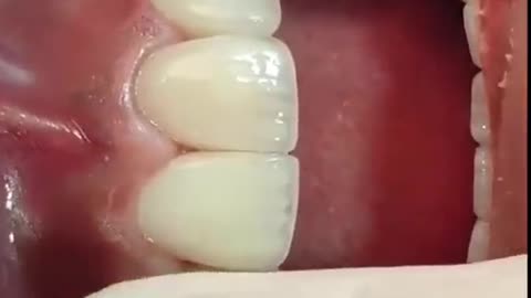 Dental - Healthy Teeth