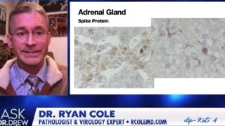 Dr Ryan Cole’s latest groundbreaking findings show spike protein