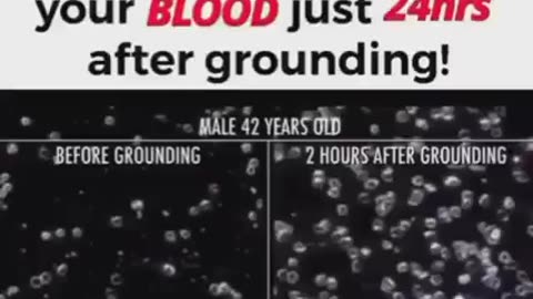 Look what happens to your BLOOD just 24hrs after grounding