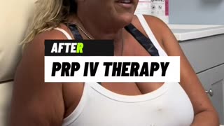 Before & After: Platelet-Rich Plasma (PRP) IV Therapy