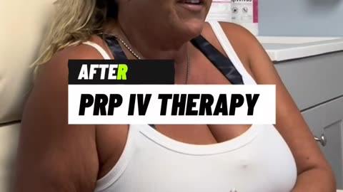 Before & After: Platelet-Rich Plasma (PRP) IV Therapy