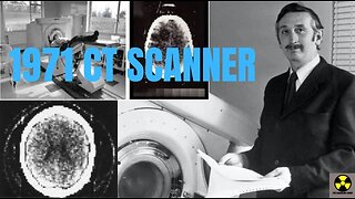 The 1971 CT Scanner