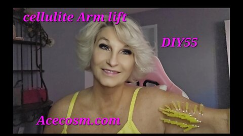 Cellulite Arm lift Acecosm.com DIY55 pdo threads