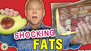 Are FATS BAD For You & Your Body? (Real Doctor Reviews The TRUTH)